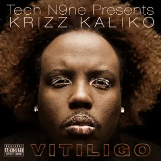 Krizz Kaliko – Vitiligo