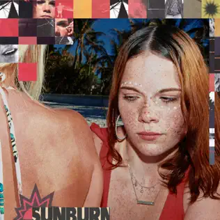 Dominic Fike Sunburn